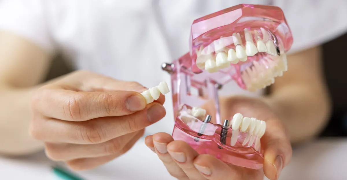 Dental Implants in Cherry Hill & Marlton: What to Expect From the Process